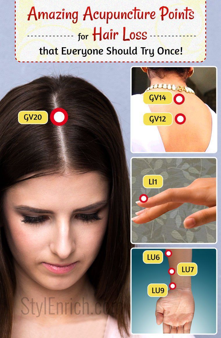 Amazing Acupuncture for Hair Loss That Everyone Should Try Once! |  