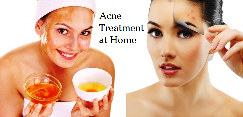 HOW TO GET RID OF ACNE AT HOME?