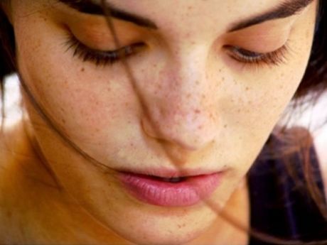 Remove hyper pigmentation With These Easy Home Remedies